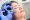 dr jing wang injecting rejuran