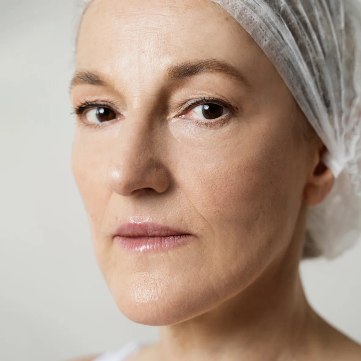 Dr Jing Wang patient photo before injectables anti wrinkle injection treatment in sydney
